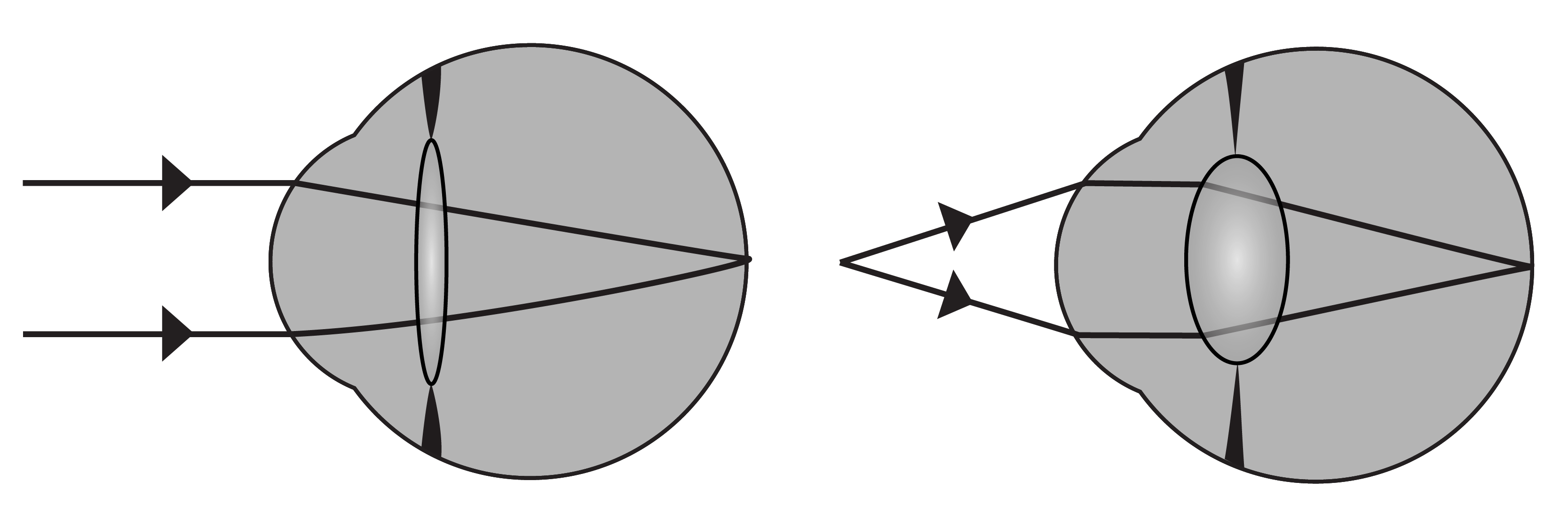 Ray diagram showing light focusing in the human eye. Parallel rays from a distant object are refracted by the cornea and crystalline lens to converge at the retina, forming a sharp inverted image on the photoreceptor layer.