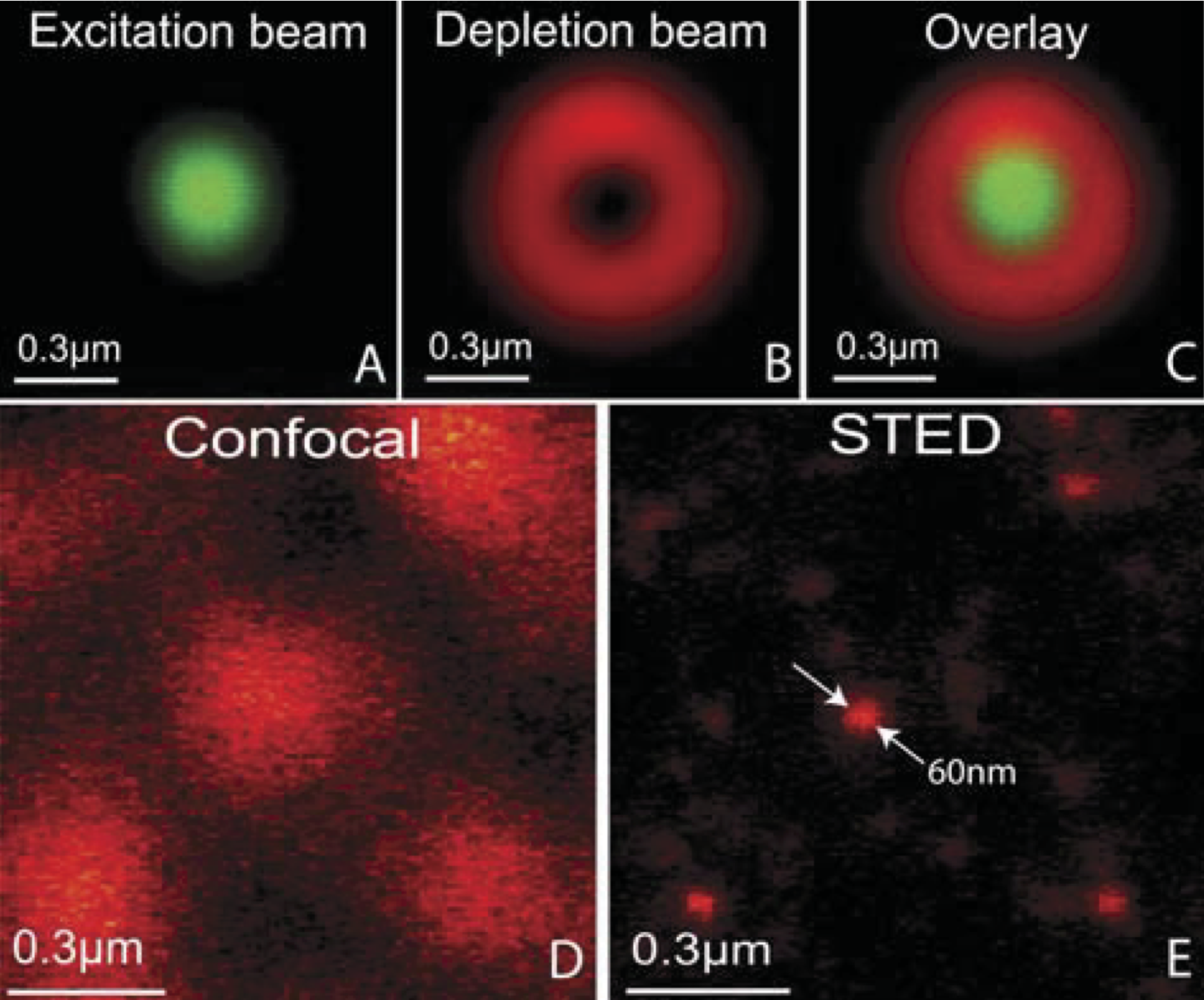 Spot used for excitation (top left) and for depletion (top middle). Fluorescence signal top right. In the lower figure the confocal image is compared to the STED image. (P.F. Rodriguez and al., Building a fast scanning stimulated emission depletion microscope, Materials Science (2012))
