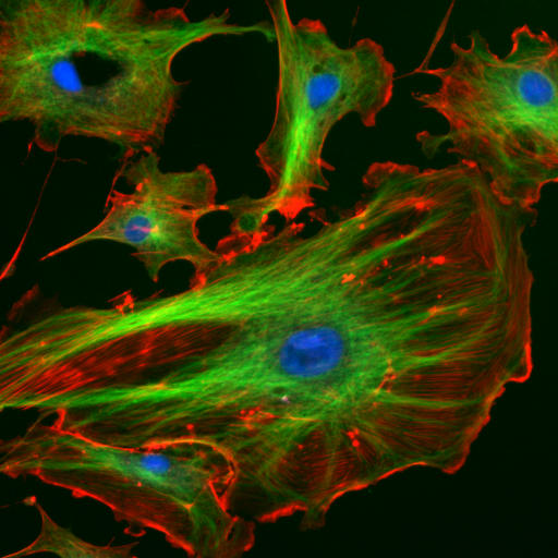 Endothelial cells under the microscope using fluorescence microscopy. The different colors enlighten different GFP.