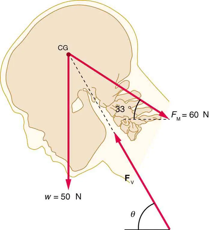 The head of a person working at a drafting board in relaxed position is 
shown. The inclination of the head is theta to the horizontal and the center 
of gravity is near the top of the head. The weight of the head is fifty 
newtons and is acting downward at the center of gravity. Three major forces 
are shown. The force exerted along the neck is sixty newtons.